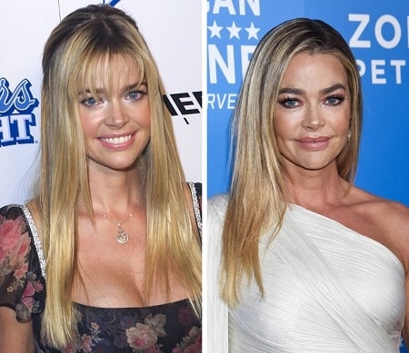 A picture of Denise Richards before (letf) and after (right).